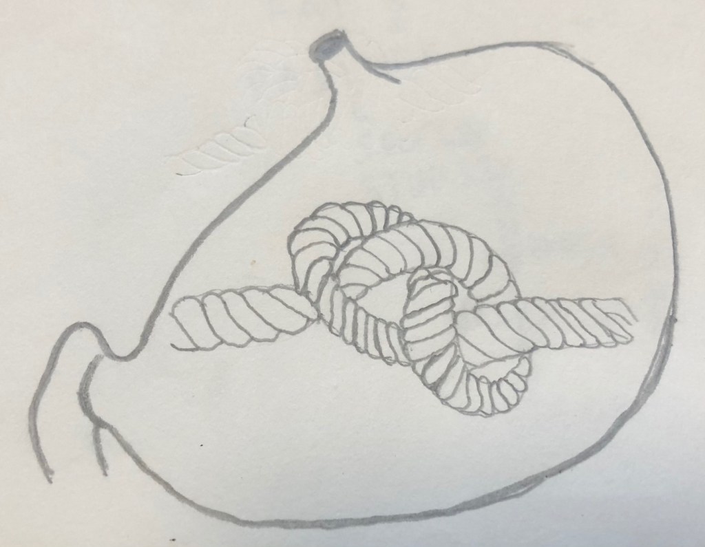 overwhelming anxiety stomach in knots 